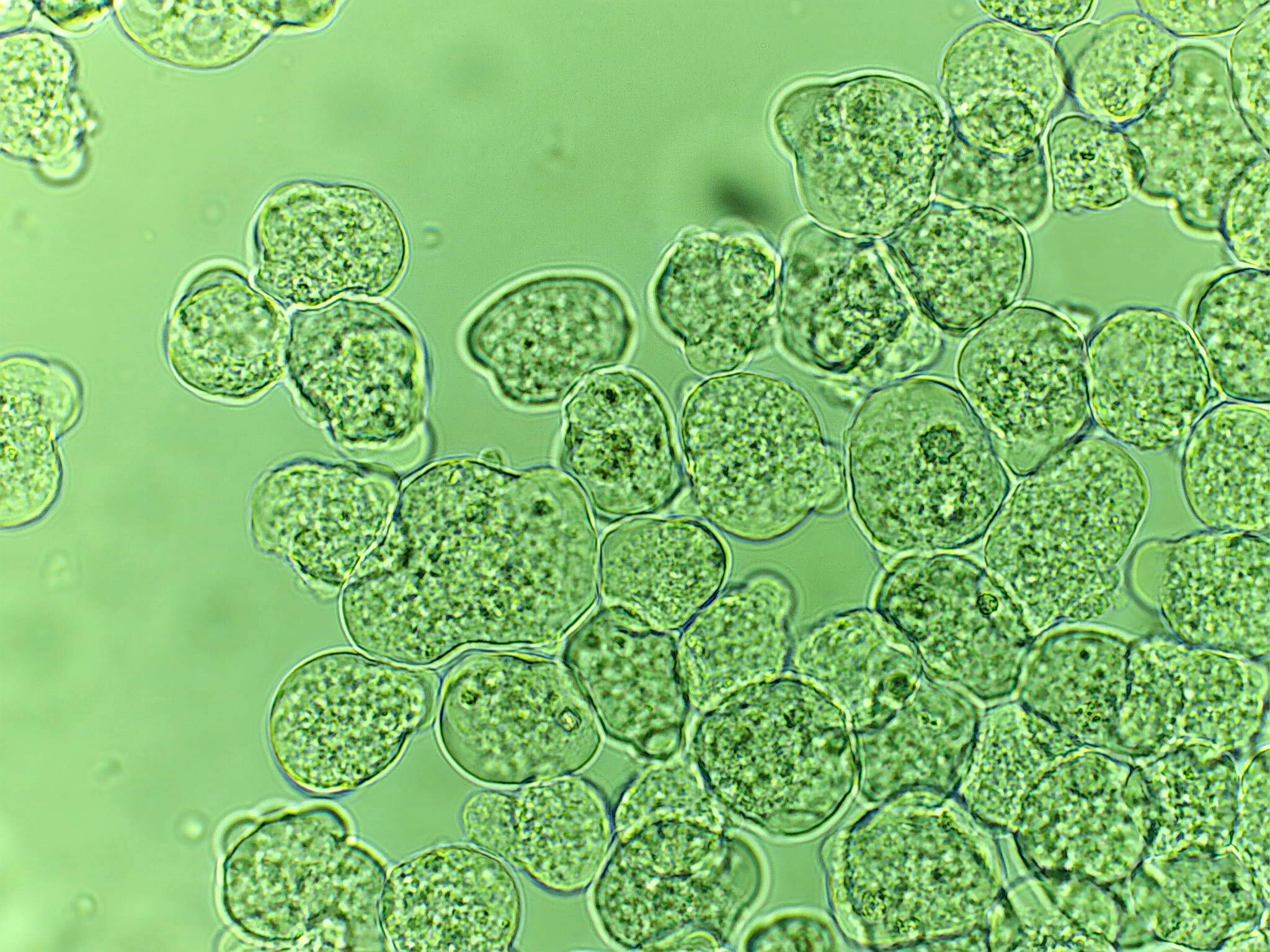 Entamoeba Histolytica Microscope